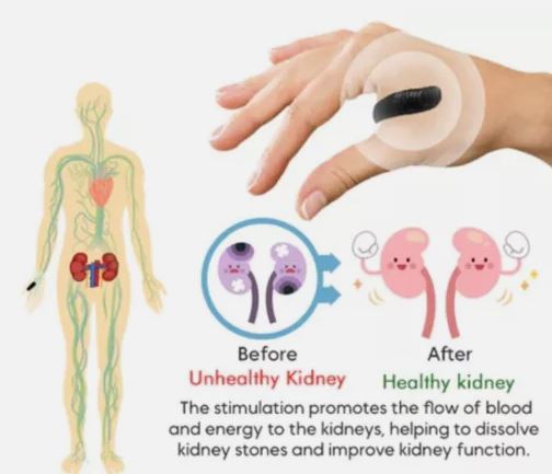 Sugar Control Acupressure Clip